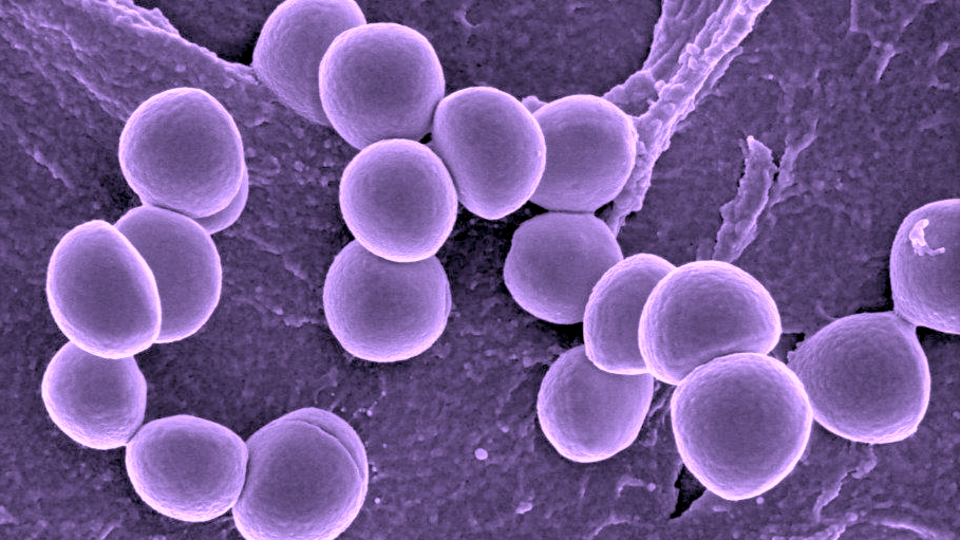 Staphylococcus aureus is a versatile bacterium that is commonly found on the skin or noses of people and animals.