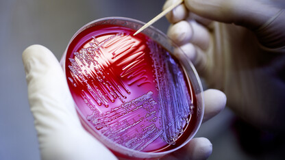 A Nebraska researcher transfers E.coli from gar plates growing cultures for analysis. A seven-year, Nebraska-led research project is being awarded for its work to reduce food-borne illness caused by Shiga Toxin-producing E. coli.