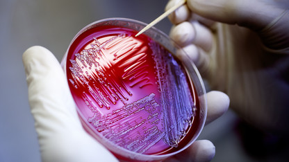 Husker-led E. coli research wins USDA award 