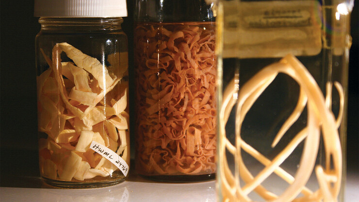 Jars of preserved parasites