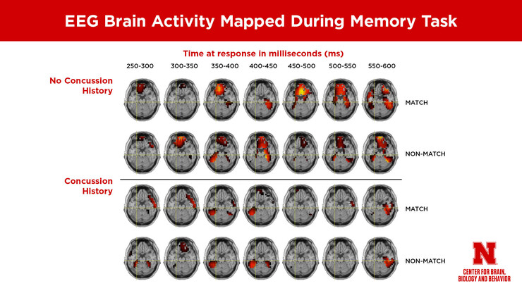 Scientists from the Center for Brain, Biology and Behavior at Nebraska used high-density electroencephalography, or EEG, to map and time electrical activity in the brain during a memory match test. The non-concussed group’s brain reactions were quicker and more concentrated to one area of the brain, in contrast to athletes with a history of concussion, who showed a delayed response, with more areas of the brain engaged.     