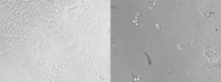 Side-by-side comparison of cells untreated versus treated with micro- and nanoplastics