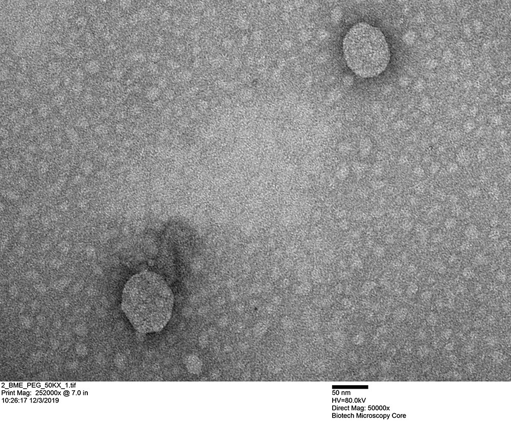 Milk exosomes (the two large circles) captured by transmission electron microscopy.