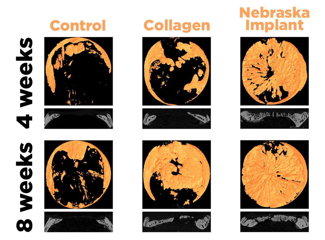 Comparison of regeneration